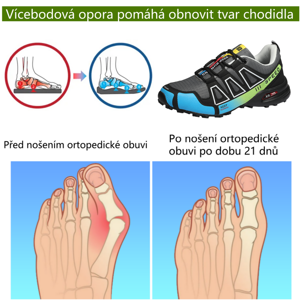 【⏰Časově omezená sleva 50 % – Nenechte si ji ujít】Nová ergonomická ortopedická obuv – ✅️Přirozeně koriguje chůzi a zmírňuje bolest – Zvýšená odolnost proti uklouznutí 👞