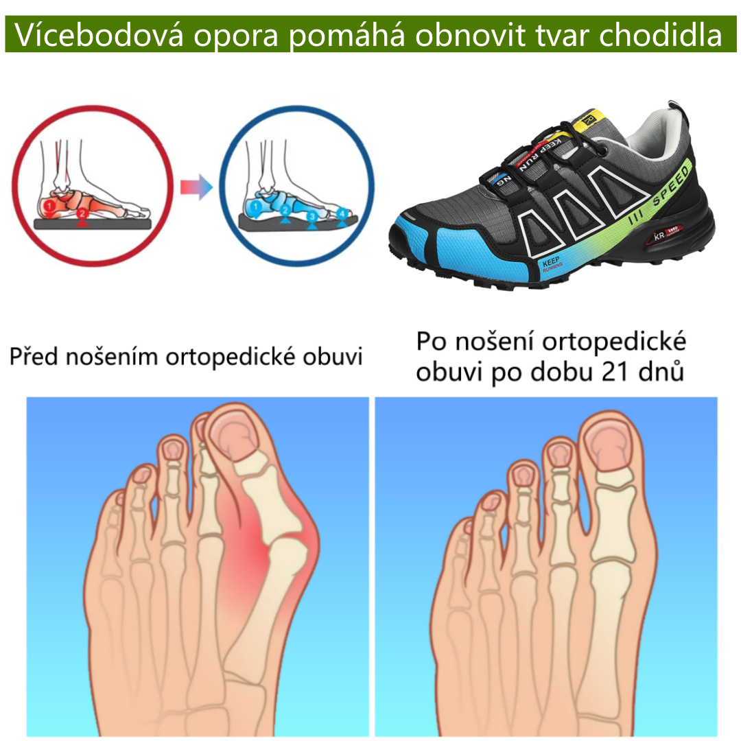 【⏰Časově omezená sleva 50 % – Nenechte si ji ujít】Nová ergonomická ortopedická obuv – ✅️Přirozeně koriguje chůzi a zmírňuje bolest – Zvýšená odolnost proti uklouznutí 👞