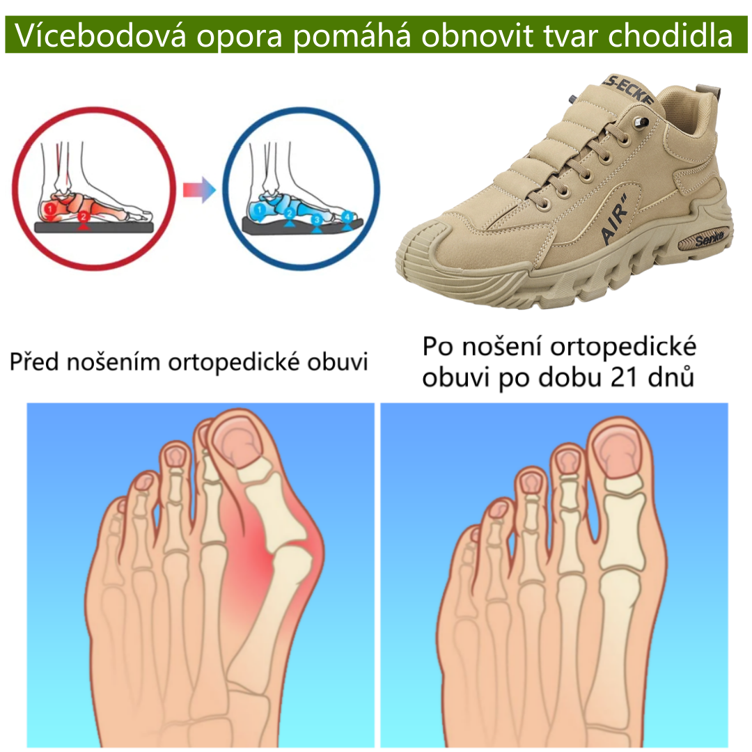 【⏰Časově omezená sleva 50 % – Nenechte si ji ujít】Zbrusu nová ergonomická ortopedická obuv – ✅️Přirozeně koriguje chůzi a zmírňuje bolest – Vylepšená voděodolnost a protiskluzovost 👞Vybraná australská kůže