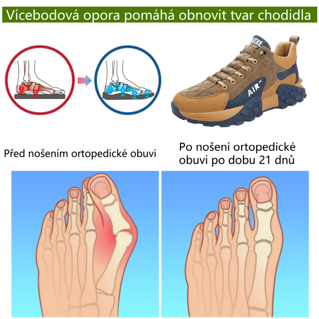 🔥 50% sleva | ortopedická obuv Rooren® | Poskytuje oporu klenby, zmírňuje bolest a usnadňuje chůzi | Vhodná pro muže i ženy.