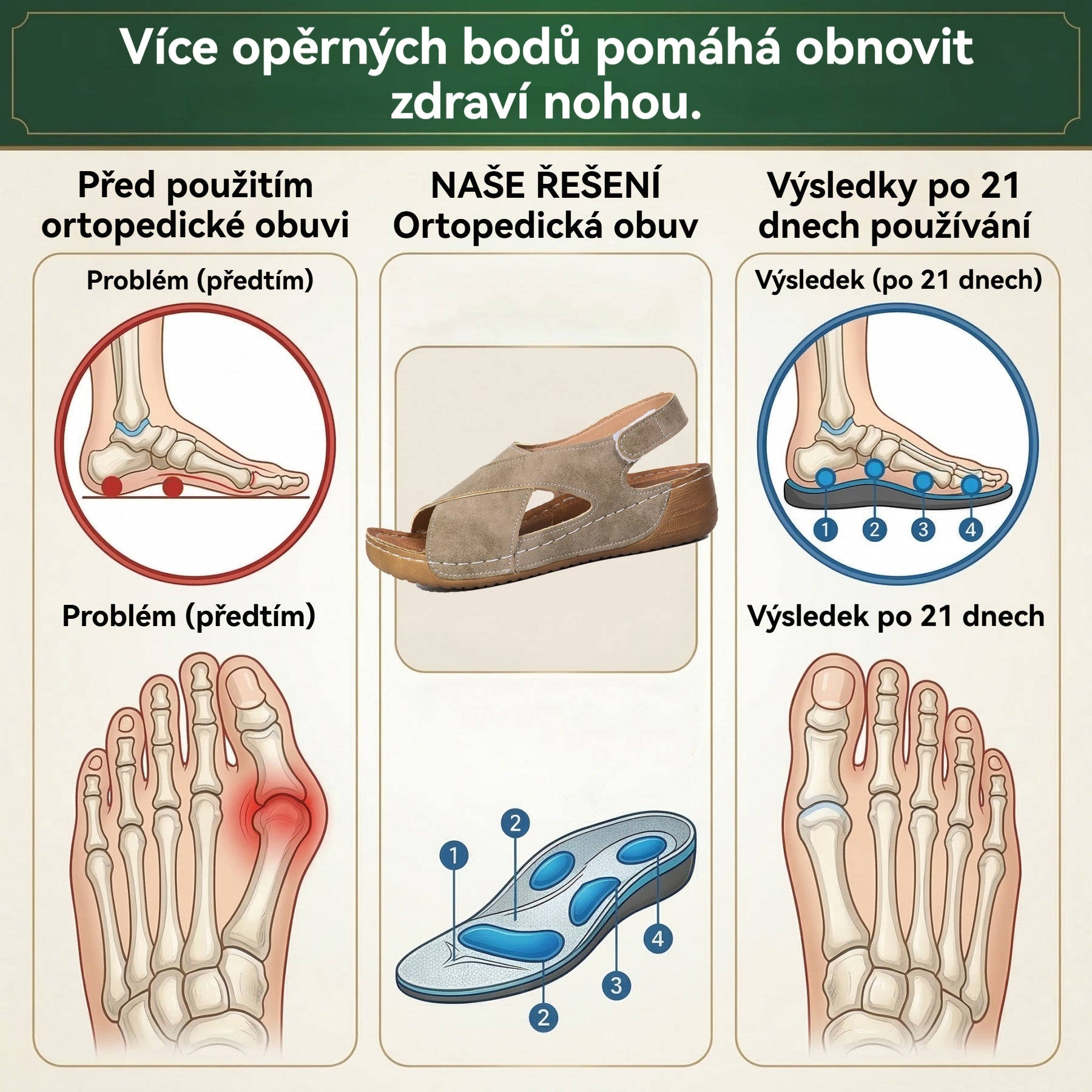 🔥 Časově omezená nabídka: sleva 50 %! Letní ortopedické sandály: ergonomicky tvarované pro pohodlí, prodyšnost a úlevu od bolesti ✅