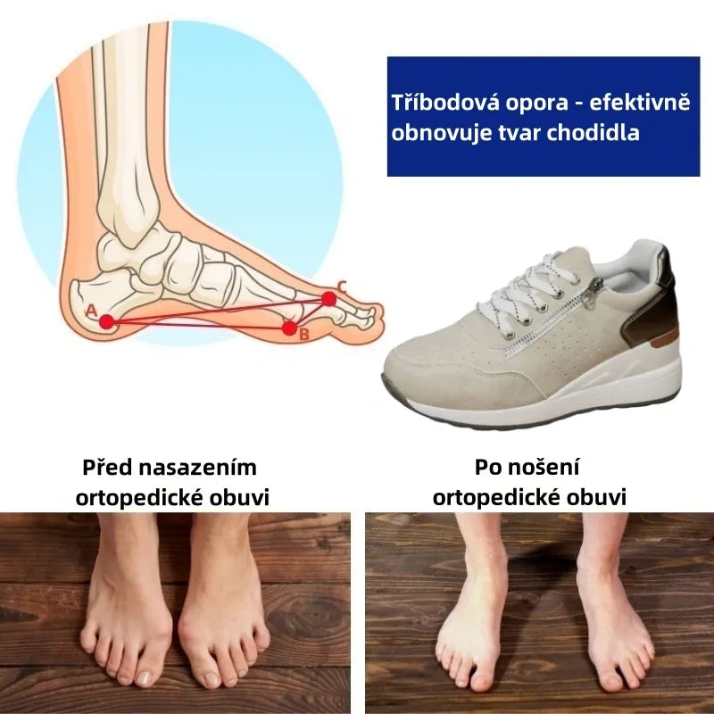 Dámská volnočasová obuv Rooren® | Pohodlné tenisky – Ergonomicky tvarovaná lékařská ortopedická obuv s oporou klenby pro účinnou úlevu od bolesti nohou.