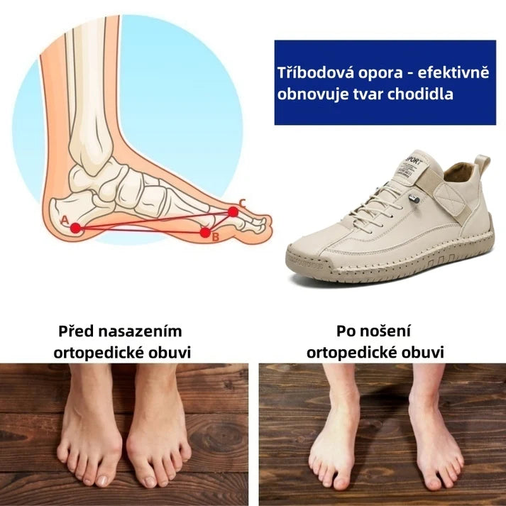Poslední den! Sleva 70 %! ✅ Ortopedická zdravotní obuv určená speciálně pro lidi s problémy s nohama k úlevě od bolesti zad, kloubů a chodidel.