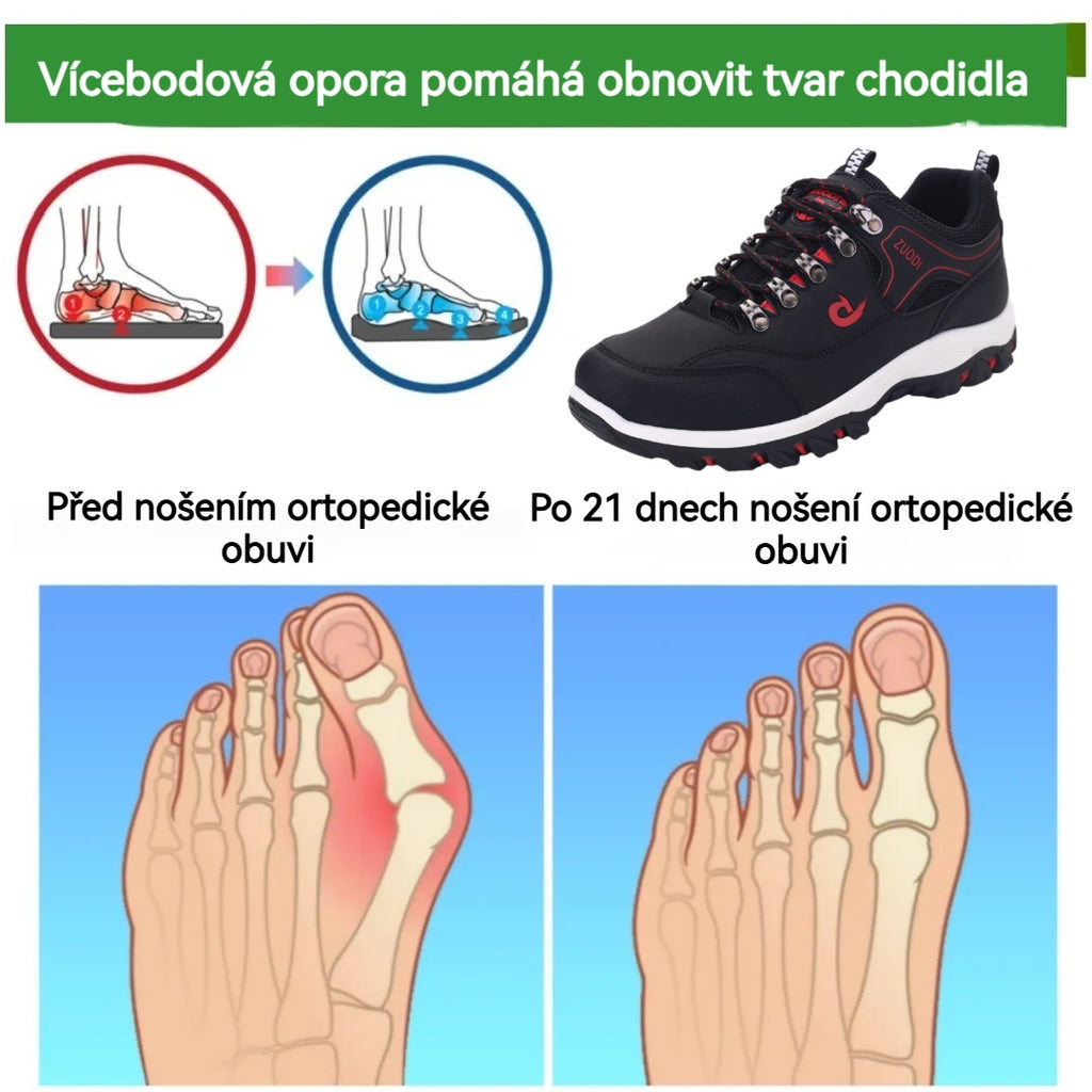 Ortopedická obuv ROOREN® – Ergonomicky navržená pro úlevu od bolesti zad, kloubů a nohou – Unisex.