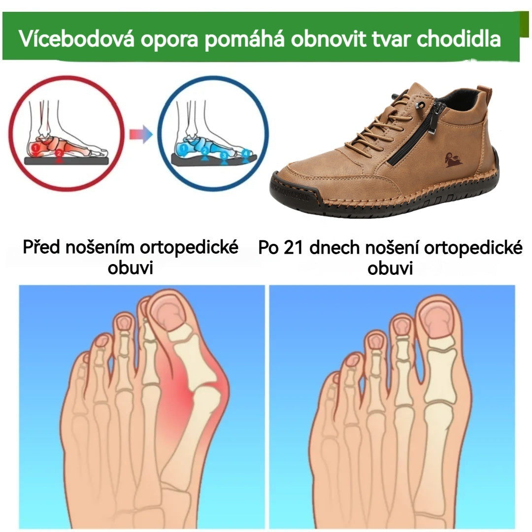 🔥 50% sleva | Ortopedická obuv ROOREN® | Poskytuje oporu klenby, zmírňuje bolest a usnadňuje chůzi | Vhodná pro muže i ženy.