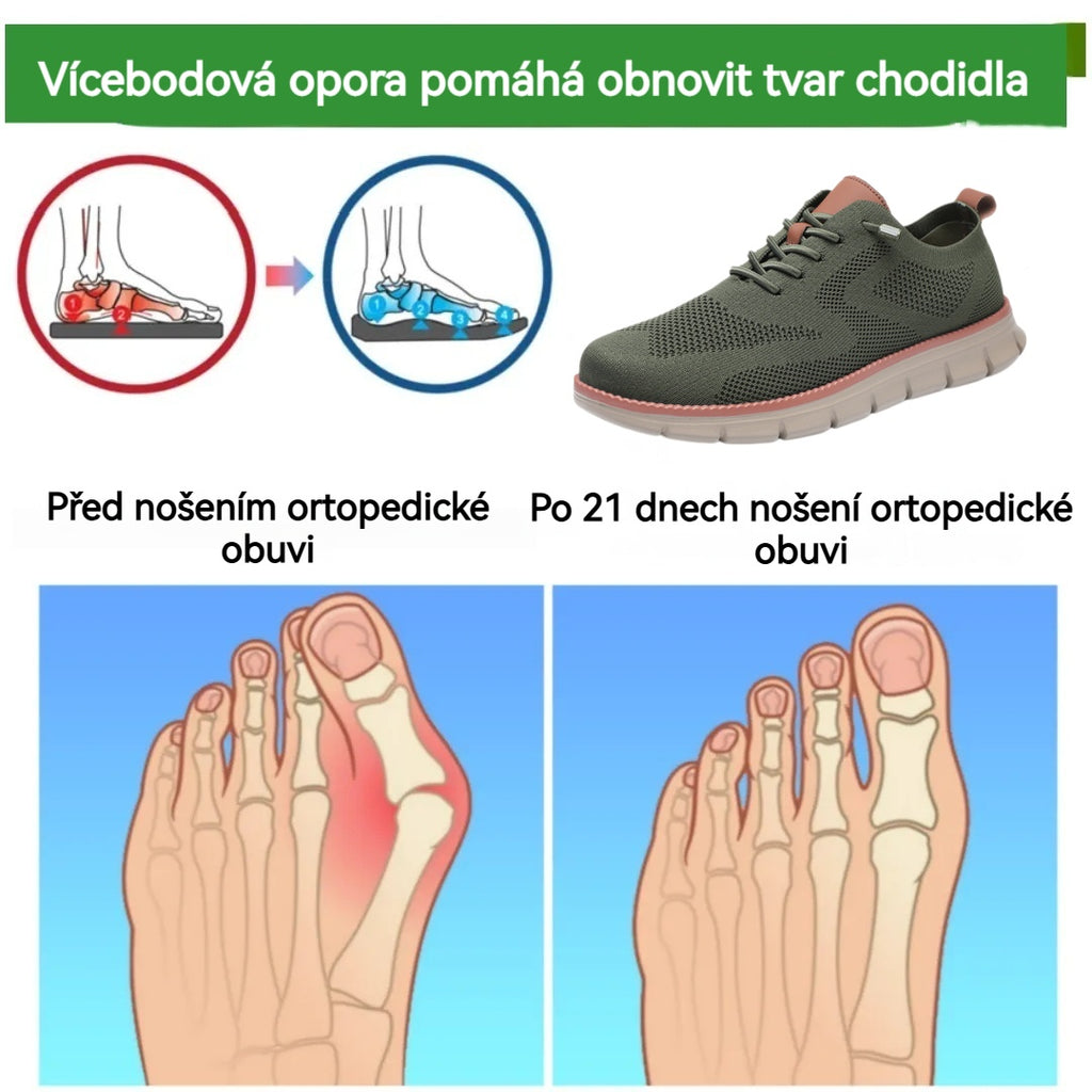 (🔥70% sleva dnes - nenechte si ji ujít!)⏰Ergonomicky tvarovaná - měkká a pohodlná ortopedická obuv, vhodná pro každodenní nošení/sport -✅Podpora klenby usnadňuje chůzi