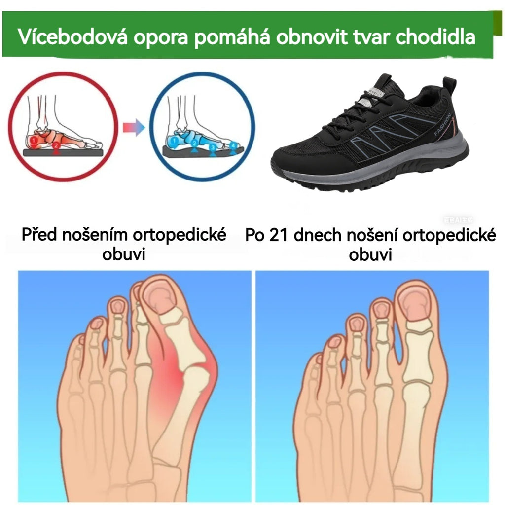 ROOREN® – Ergonomicky navržená lékařská ortopedická obuv, která ulevuje od bolesti zad, kloubů a nohou.