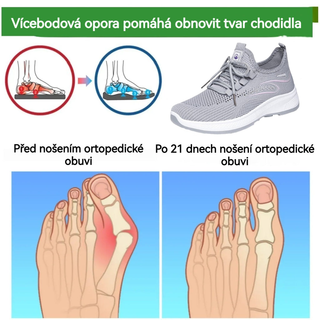 🔥 Dnes sleva 50 % – nenechte si to ujít! ⏰ Ergonomicky tvarovaná ortopedická obuv s oporou klenby 👞 Snadno ulevuje od bolesti nohou ✅ Pohodlná a prodyšná