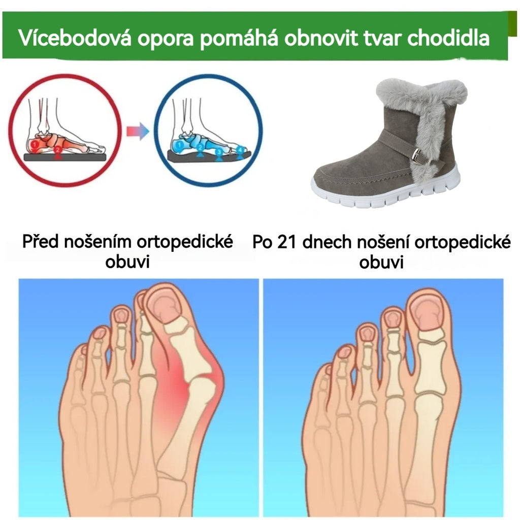 Dámské sněhule ROOREN® - Ergonomické zimní ortopedické boty s vlněnou podšívkou pro teplo a protiskluzovost. Ergonomický design účinně zmírňuje bolest nohou.