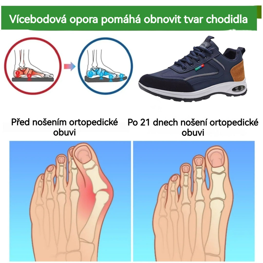 Ortopedická obuv ROOREN® – ergonomicky navržená pro bolesti zad, nohou a kloubů – unisex