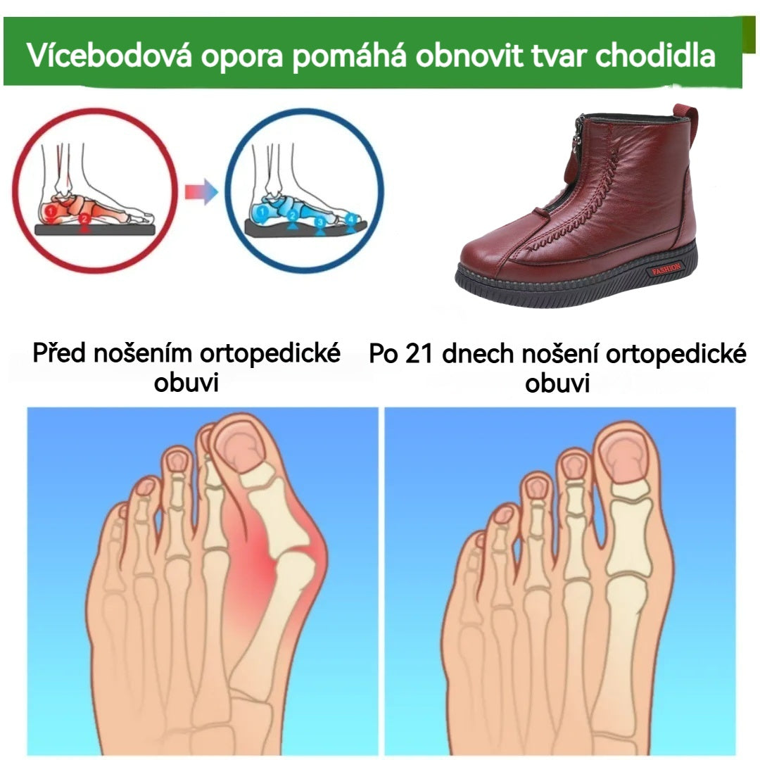 📣Časově omezená nabídka dnes - sleva 70 %⏰: ROOREN®, ergonomicky tvarovaná a bezpečná, teplá zimní ortopedická obuv. 👍Určeno pro ženy s bolestmi nohou, usnadňuje chůzi!
