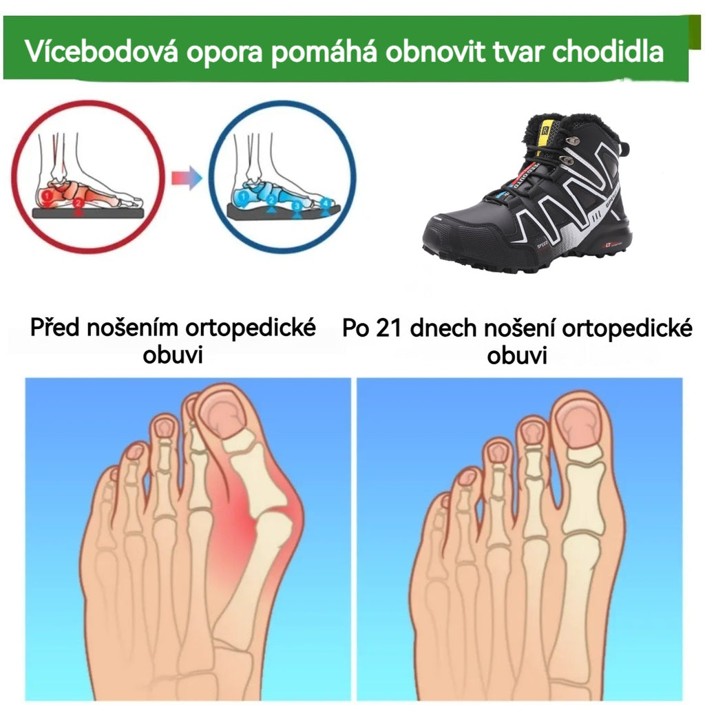 🔥Časově omezená nabídka, dnes sleva 50 %! ⏰ - Protiskluzové, teplé turistické boty ROOREN®, vědecky navržené ortopedické boty, které účinně ulevují od bolesti nohou, zad a kolen!