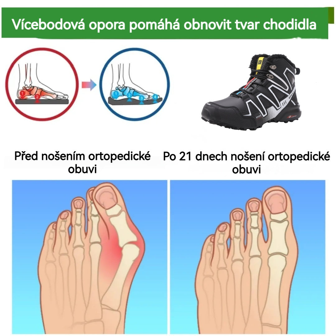 🔥Časově omezená nabídka, dnes sleva 50 %! ⏰ - Protiskluzové, teplé turistické boty ROOREN®, vědecky navržené ortopedické boty, které účinně ulevují od bolesti nohou, zad a kolen!