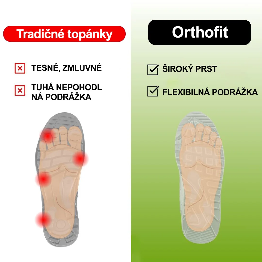 🔥 Dnes sleva 50 % – nenechte si to ujít! ⏰ Ergonomicky tvarovaná ortopedická obuv s oporou klenby 👞 Snadno ulevuje od bolesti nohou ✅ Pohodlná a prodyšná