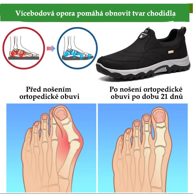 [⏰Dnes sleva 50 % - Brzy skončí🔥] Semišové ortopedické boty ROOREN® - vyrobené z příjemné látky, s podporou klenby, pohodlné a odolné, zmírňují nepohodlí nohou!